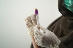 クラミジア検査を郵送で受ける際の女医によるフォローはどのようなもの？